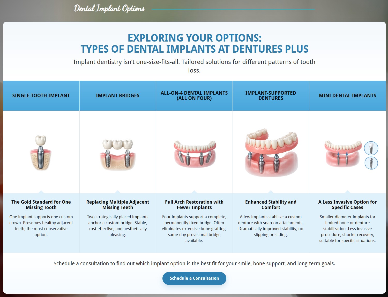 Exploring your options — the types of tooth replacement at Dentures Plus
