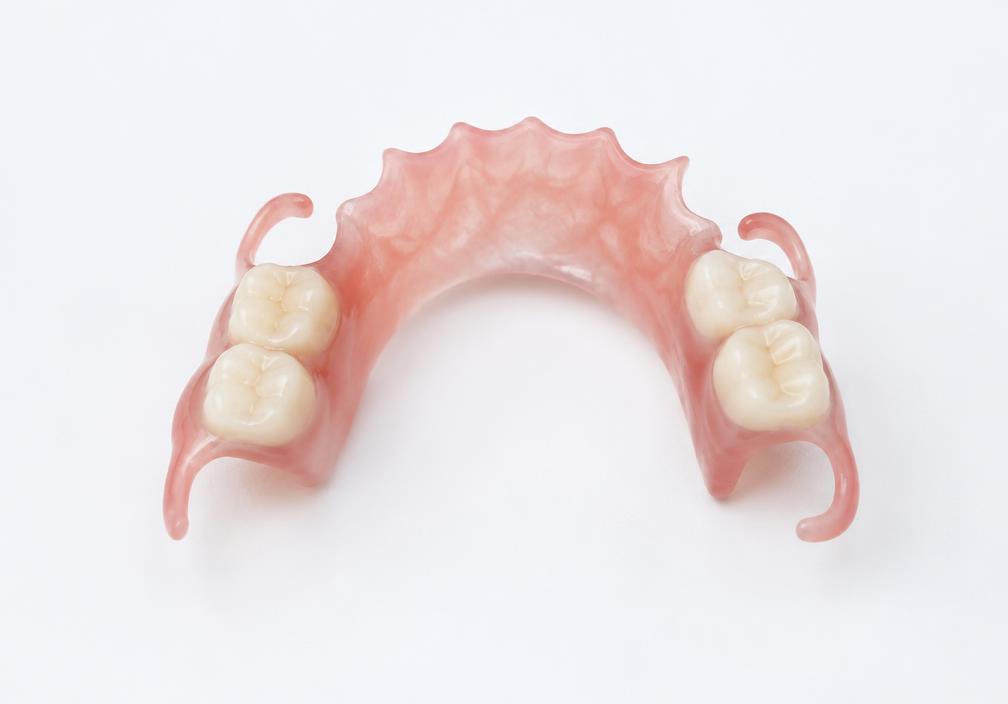 Clinical illustration of flexible partial dentures