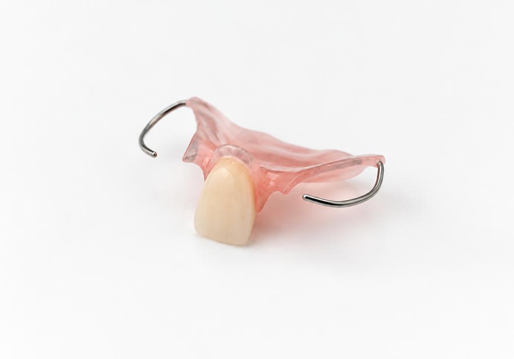 Clinical illustration of flipper dentures