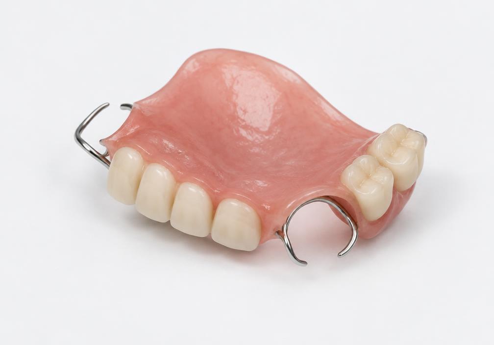 Clinical illustration of transitional dentures